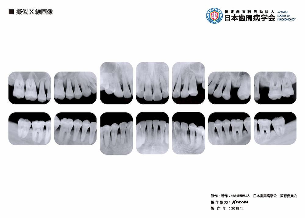 疑似X線画像